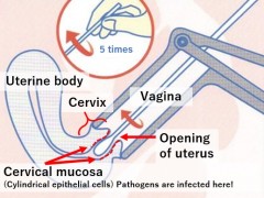 female: pelvic examination